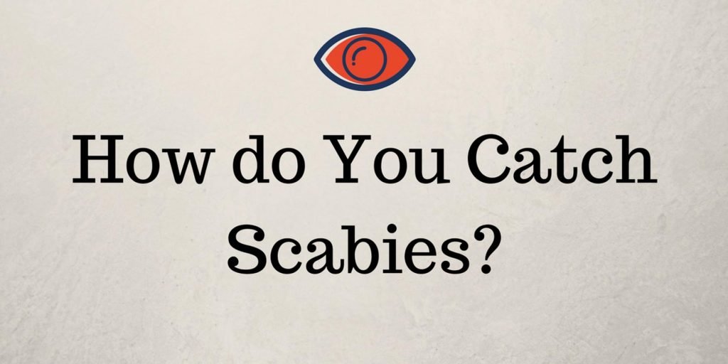 how to d you get scabies